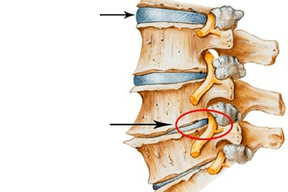 al'ada da lalacewa kashin baya tare da ervical osteochondrosis