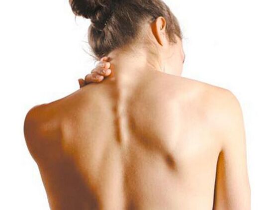 Yarinyar tana da ervical osteochondrosis