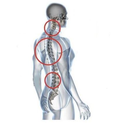 rukunin spinal ostteochondrosis