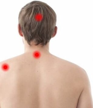 wurin jin zafi a cikin mahaifa osteochondrosis