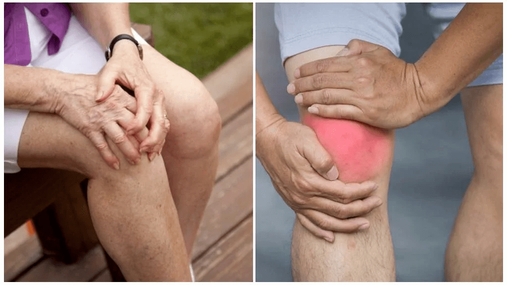 maganin arthrosis